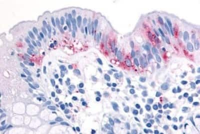 Immunohistochemistry-Paraffin: MAP3K8/Tpl2/COT Antibody [NBP3-14395] - Immunohistochemistry of formalin-fixed, paraffin-embedded human colon after heat-induced antigen retrieval.